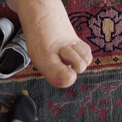 DOESN’T LEAVE PAINFUL SKIN MARKS.